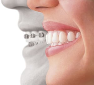 Orthodontic Dentistry